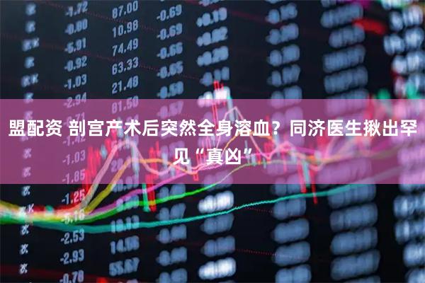盟配资 剖宫产术后突然全身溶血？同济医生揪出罕见“真凶”